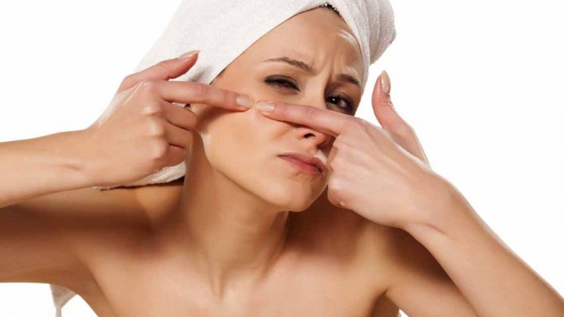 Không nên năn mụn đầu đen