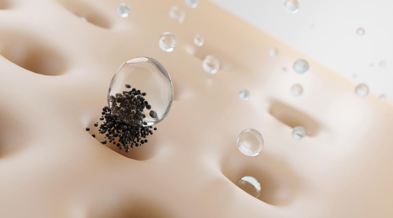 Mụn đầu đen ở má