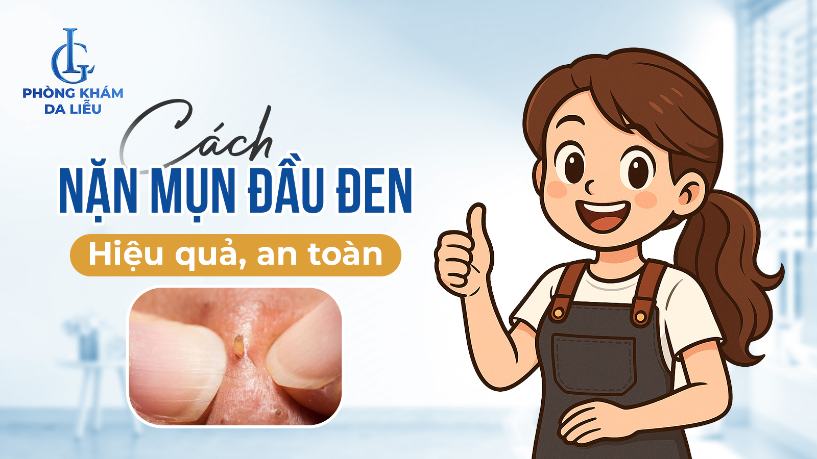 Cách nặn mụn đầu đen