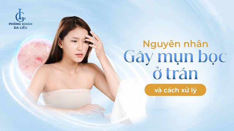Mụn bọc ở trán