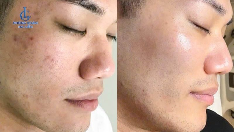 Kết quả điều trị 