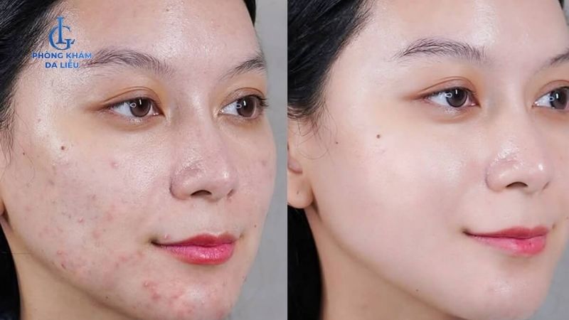 Kết quả điều trị