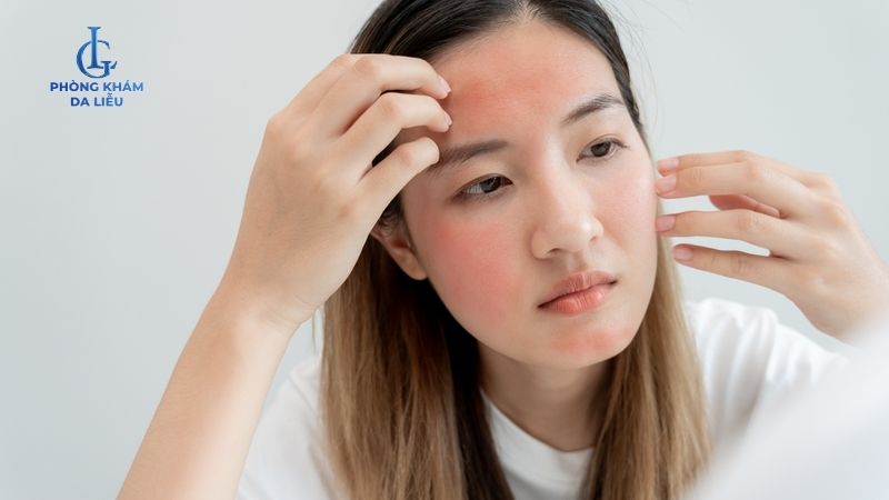 Peel da bị đỏ rát có sao không