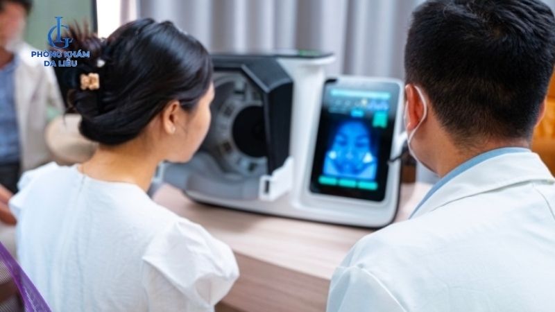 Peel da bị đỏ rát