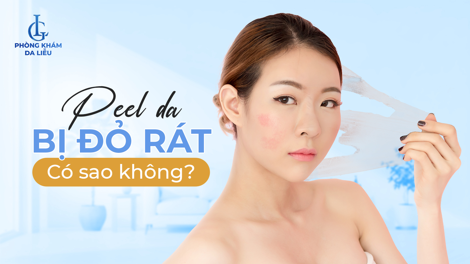 Peel da bị dỏ rát