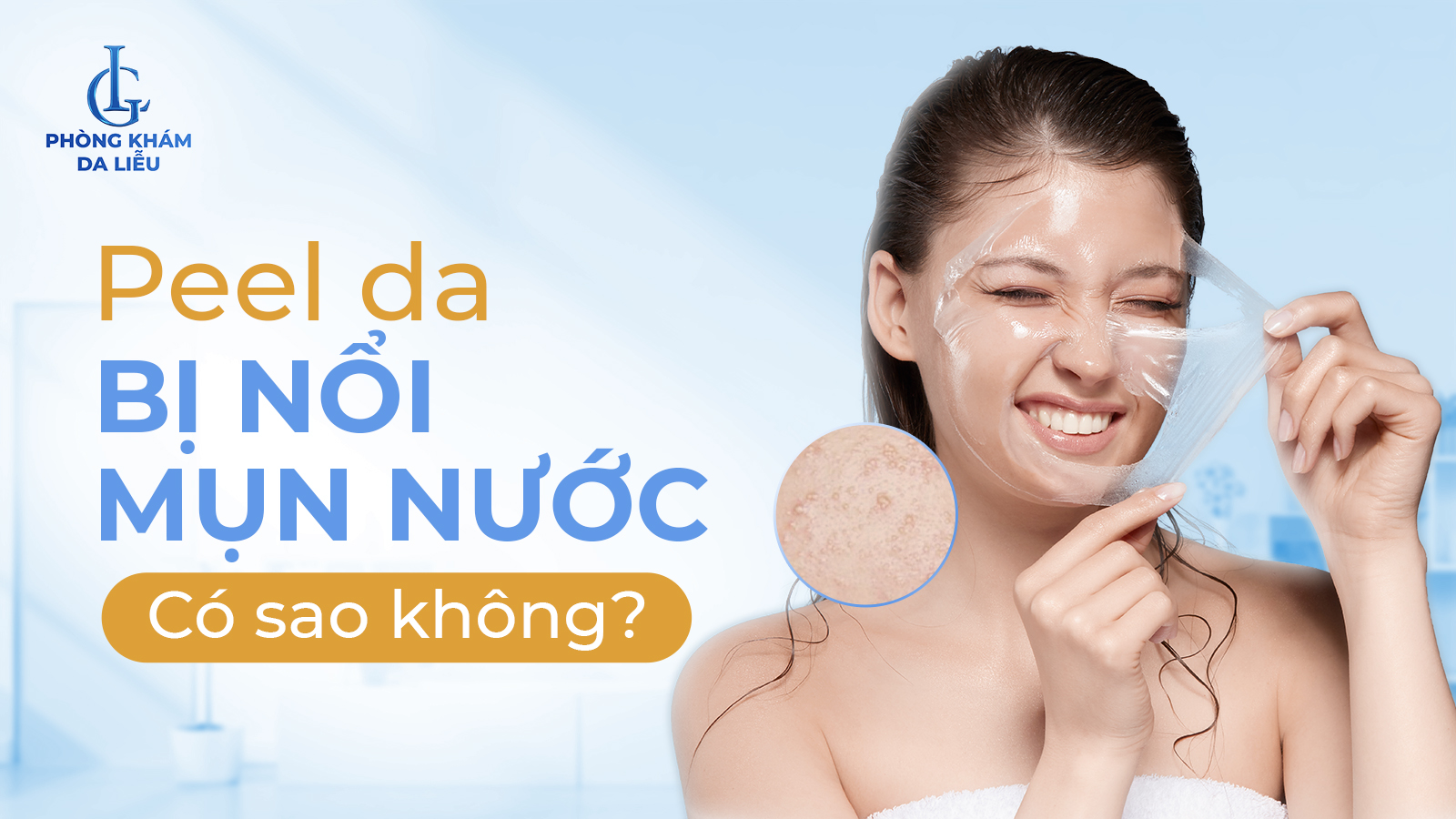 Peel da bị nổi mụn nước