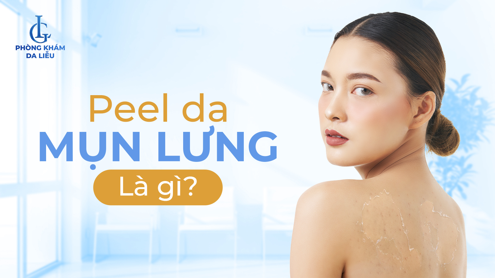 Peel da mụn lưng