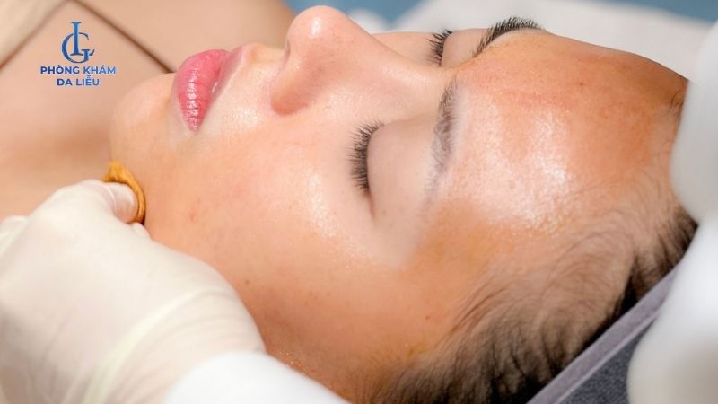 Peel da trị mụn giá bao nhiêu