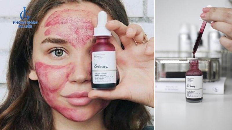 Các bước peel da tại nhà