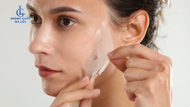 Peel da trị mụn tại nhà