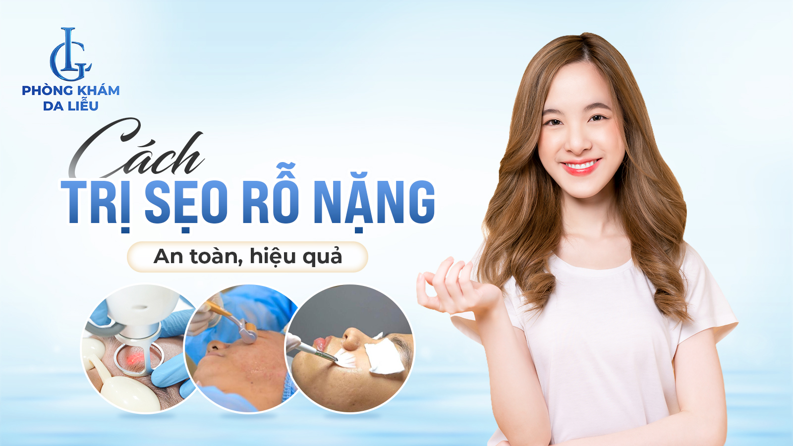 Sẹo rỗ nặng