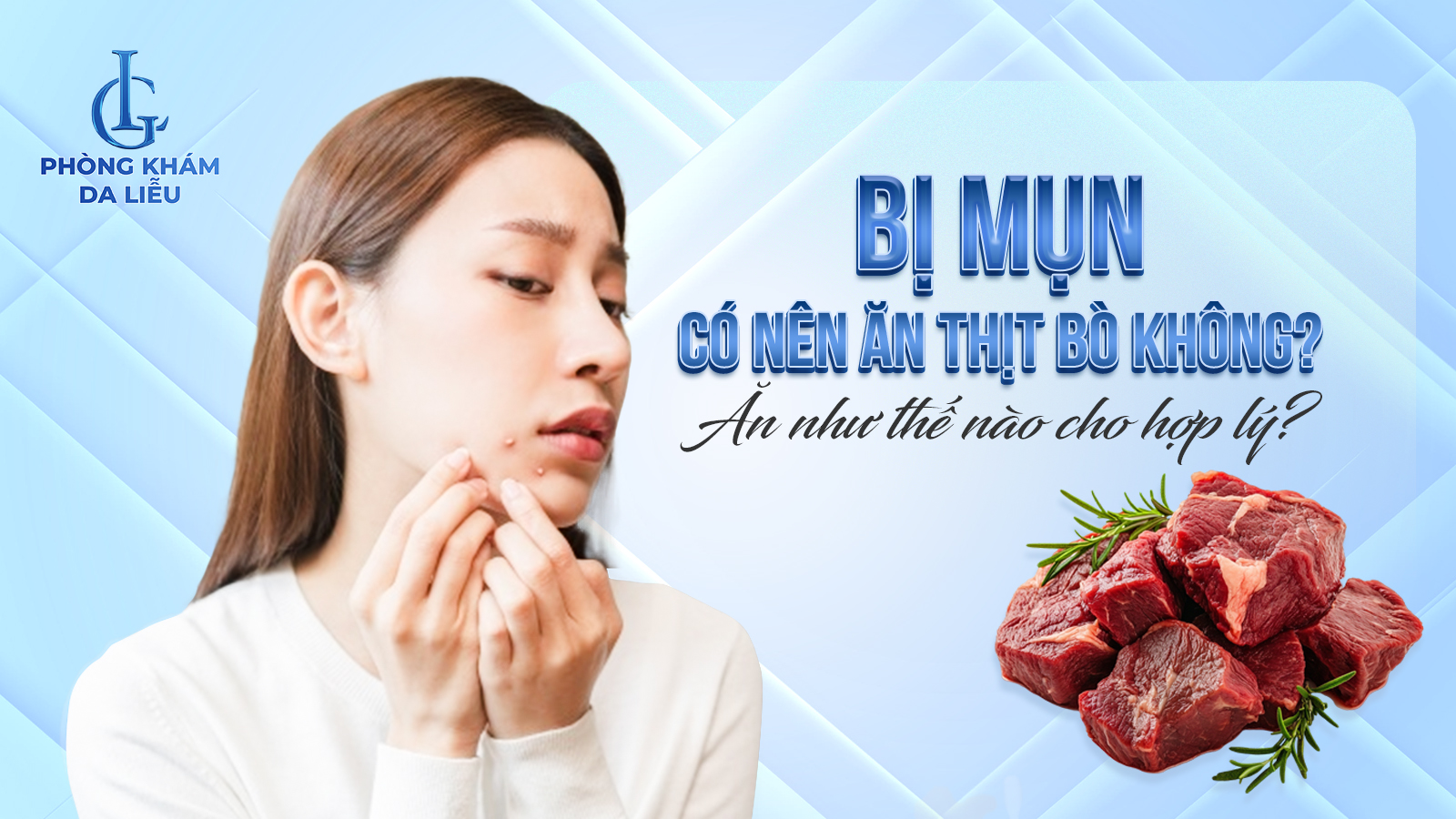 Bị mụn có nên ăn thịt bò không
