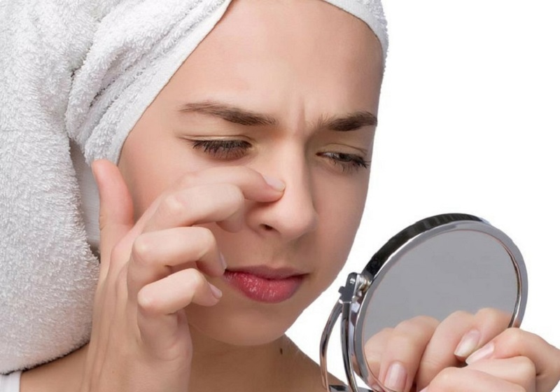 Cách trị mụn đầu đen ở mũi bằng vaseline