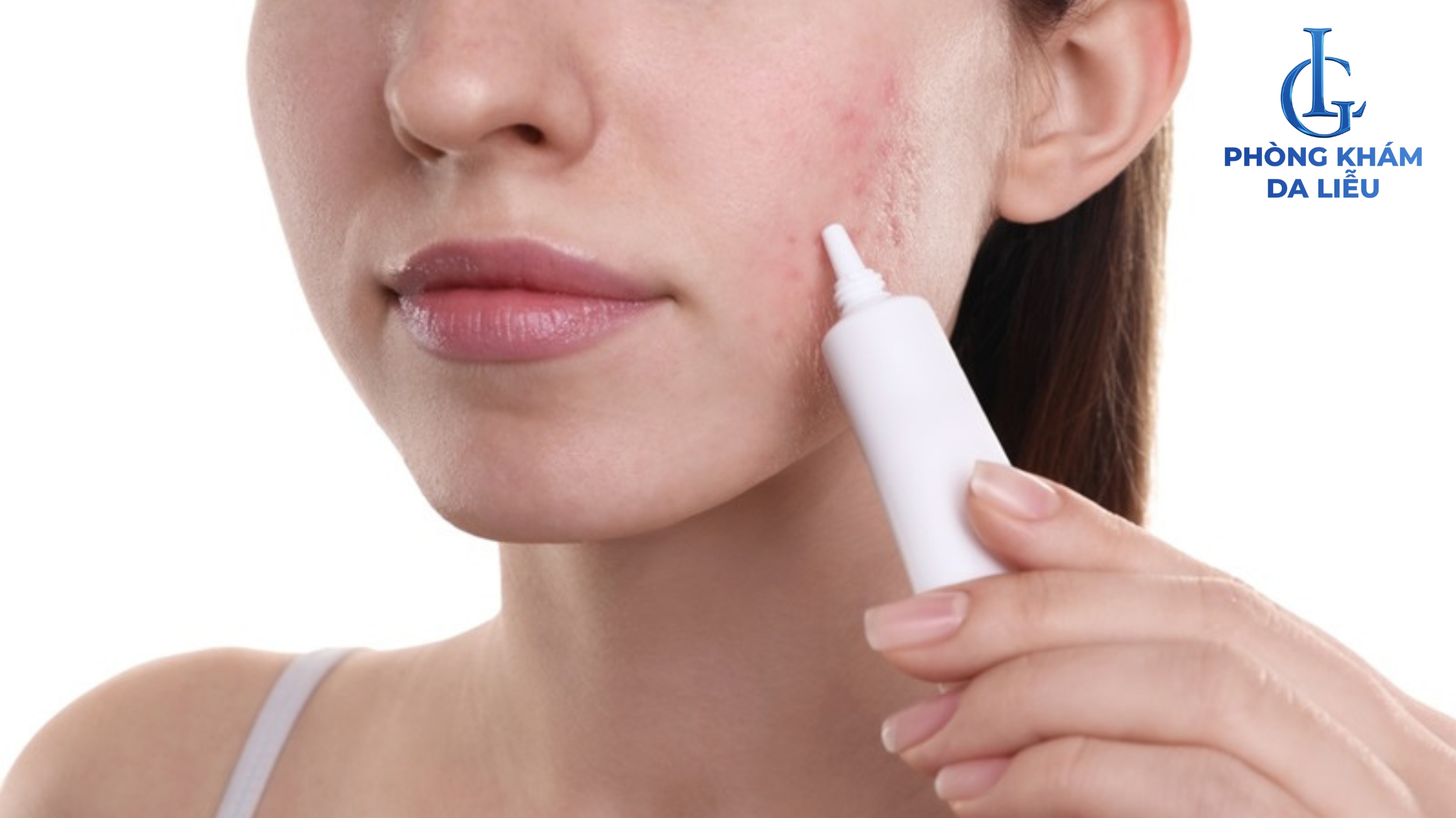 Bôi kem dưỡng da