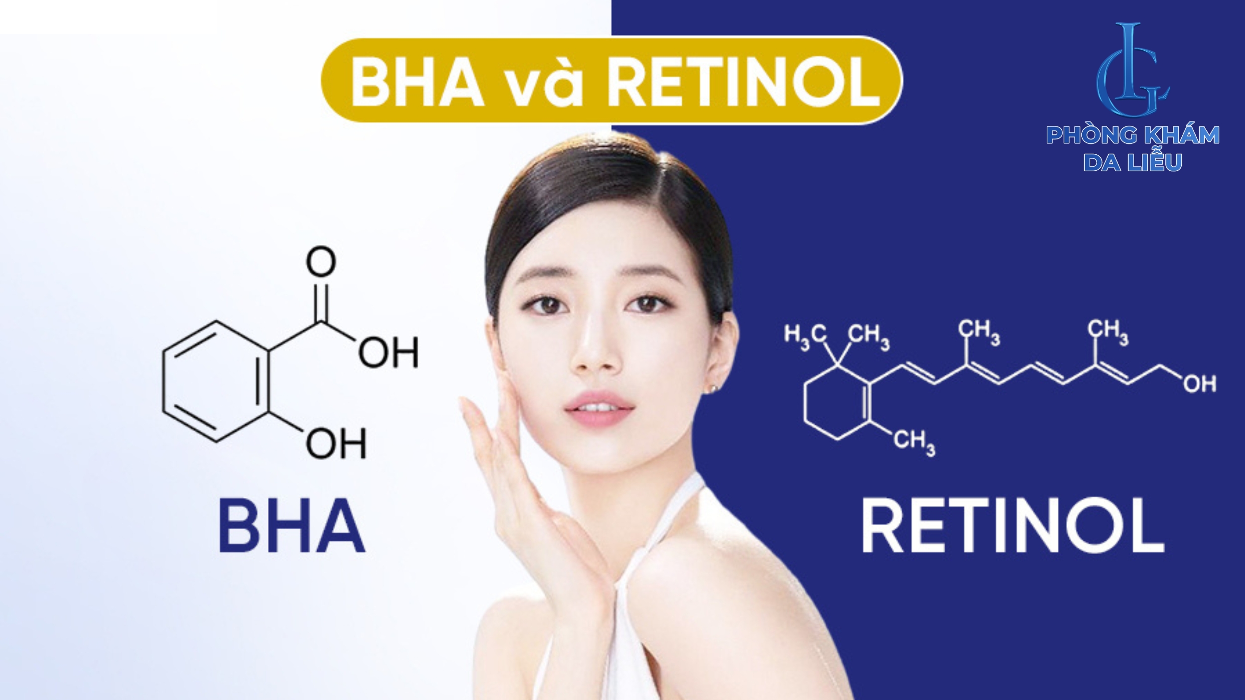 mụn ẩn nên dùng bha hay retinol