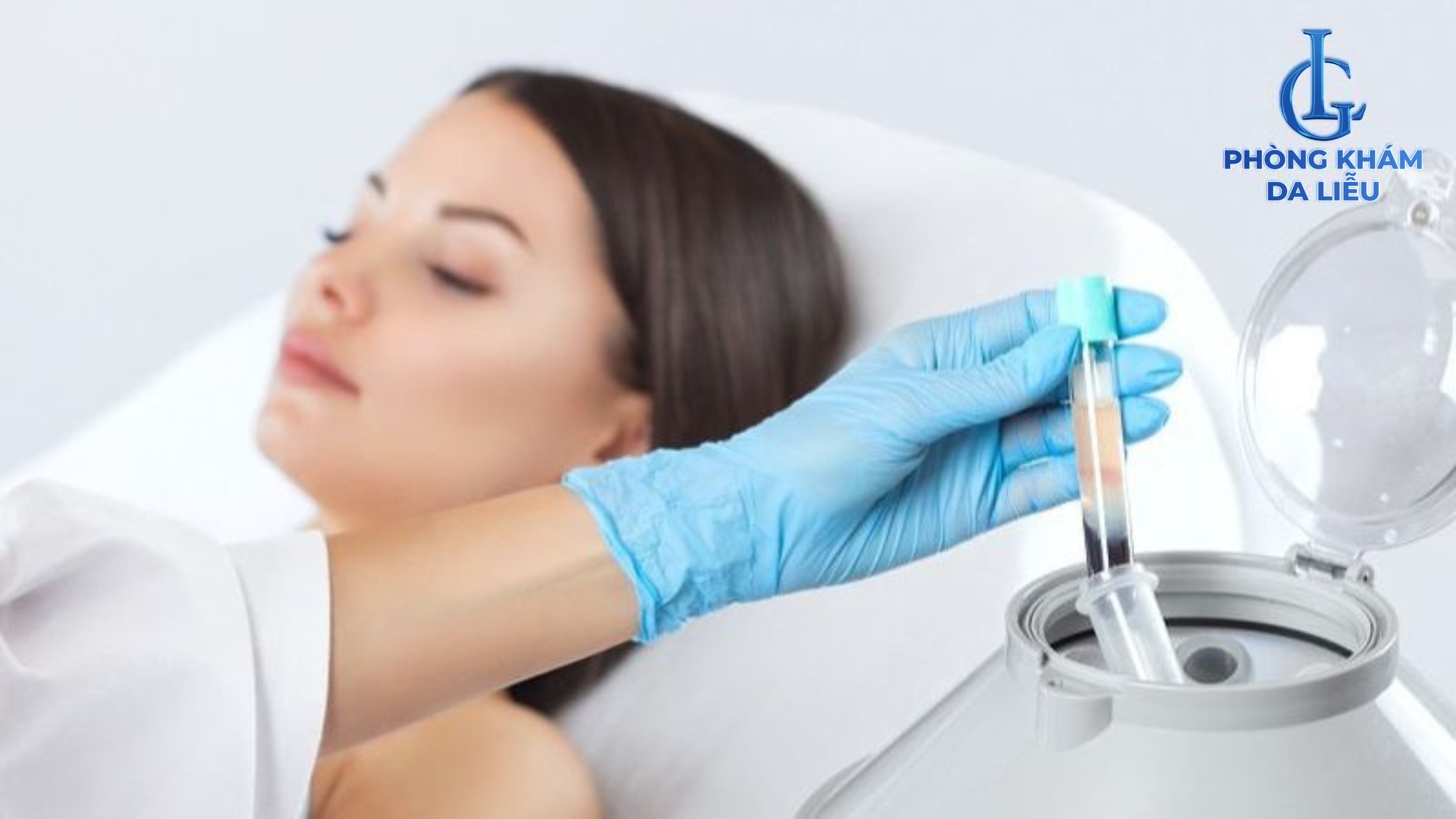 Tế bào gốc trị sẹo rỗ