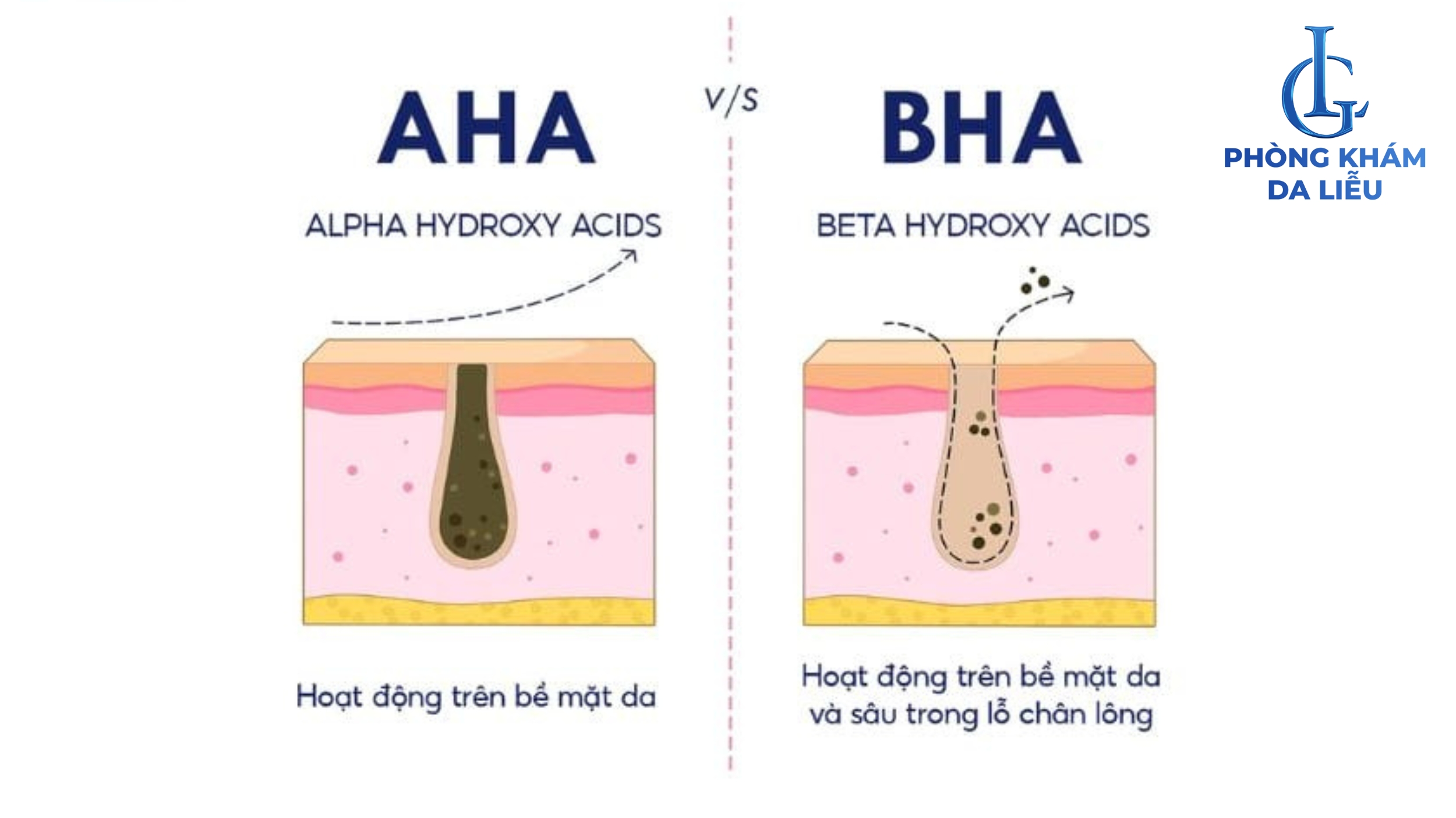 Phân biệt AHA và BHA