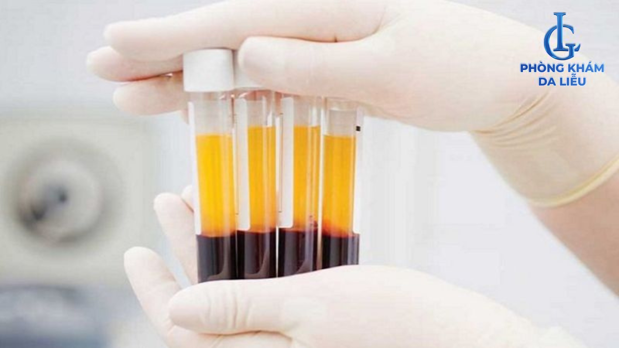 Tế bào gốc tự thân