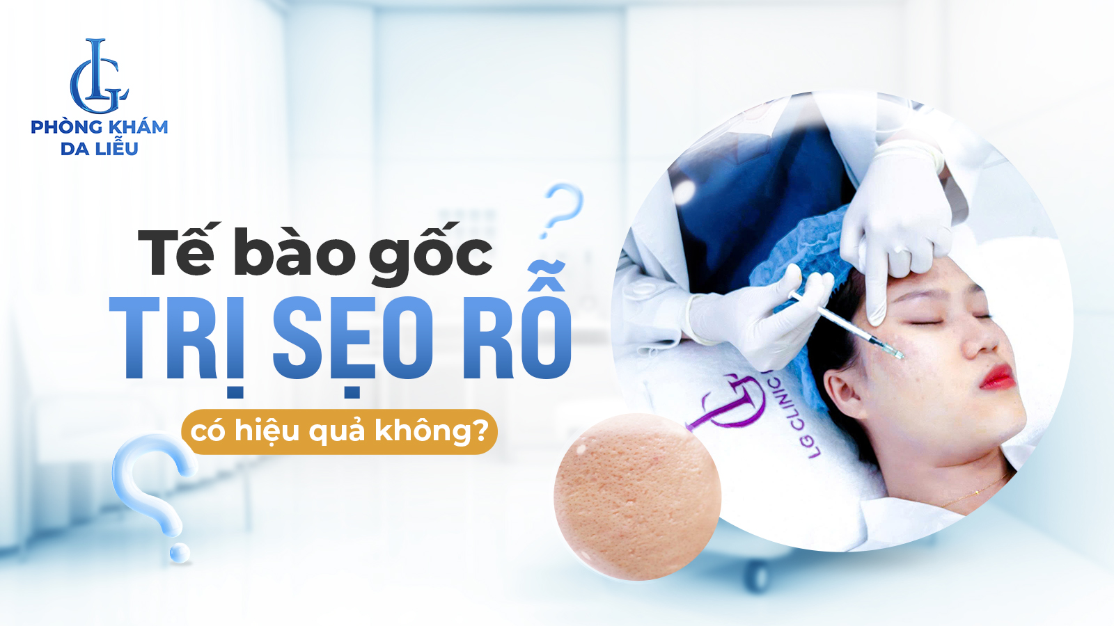 Tế bào gốc trị sẹo rỗ tốt nhất hiện nay