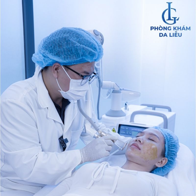 Công nghệ laser trị sẹo rỗ