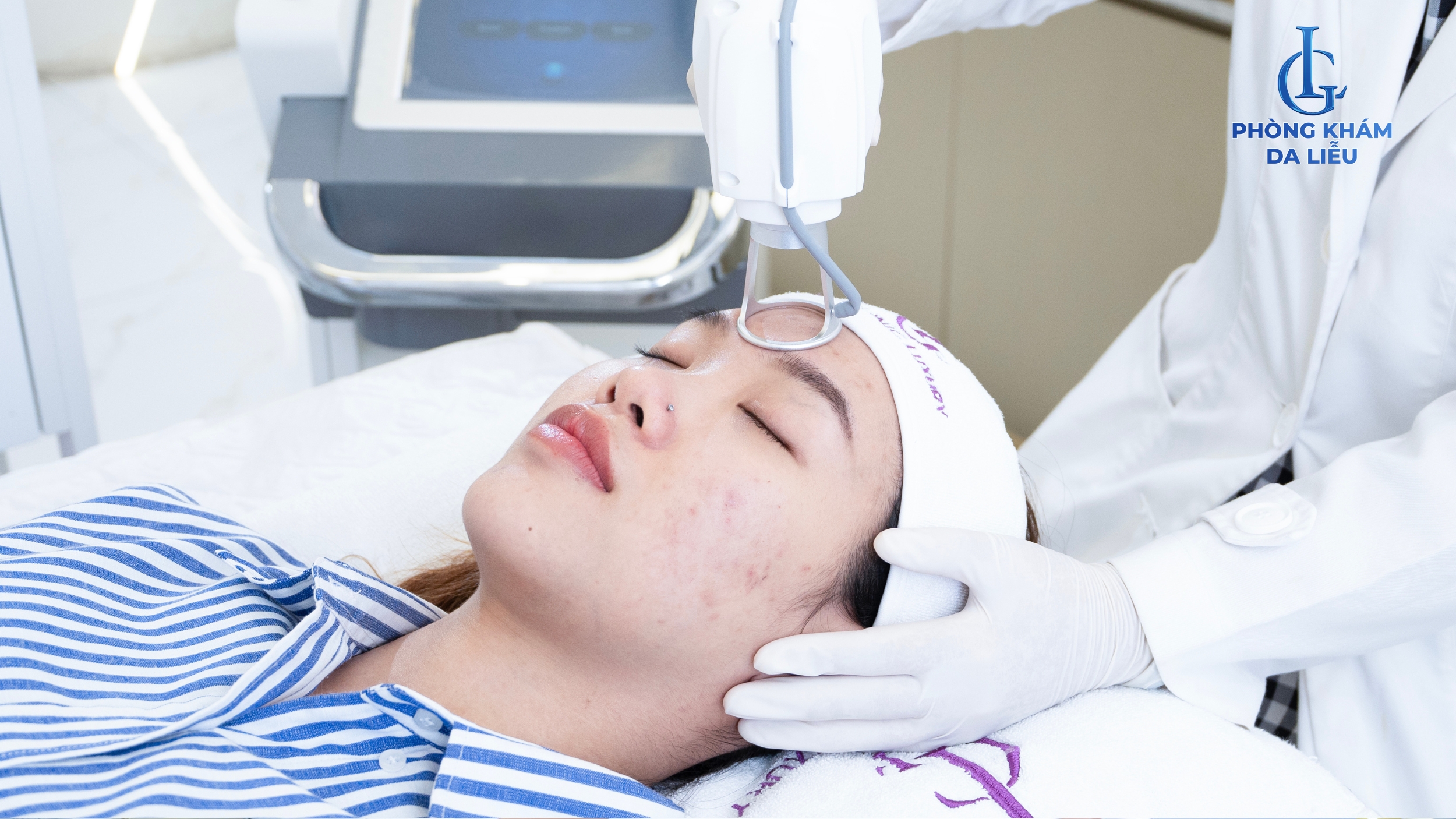 trị sẹo rỗ bằng laser CO2