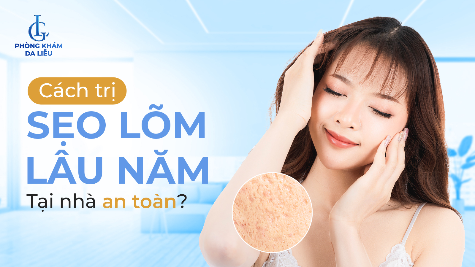 Trị sẹo lõm lâu năm tại nhà