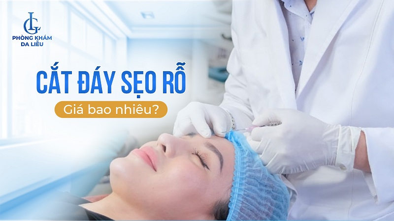 cắt đáy sẹo rỗ giá bao nhiêu