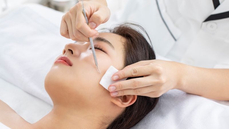 Quy trình nặn mụn ẩn