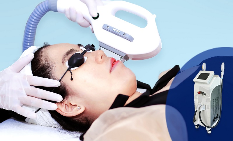 công nghệ ipl trị mụn