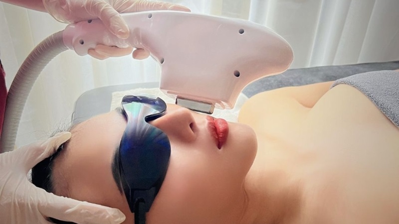 công nghệ ipl trị mụn