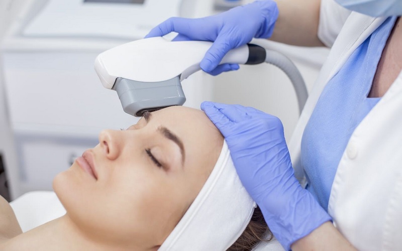 công nghệ ipl trị mụn