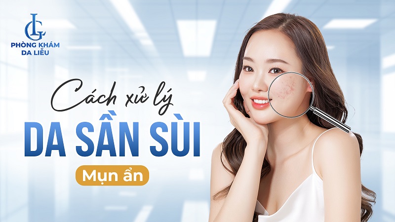 da sần sùi mụn ẩn​