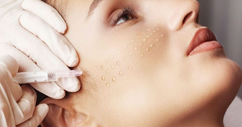 Đối tượng phù hợp với Meso trị sẹo rỗ