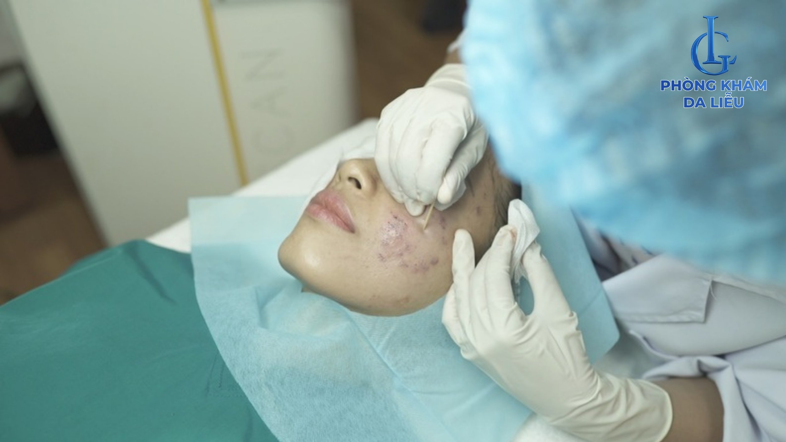 Cắt đáy sẹo lõm