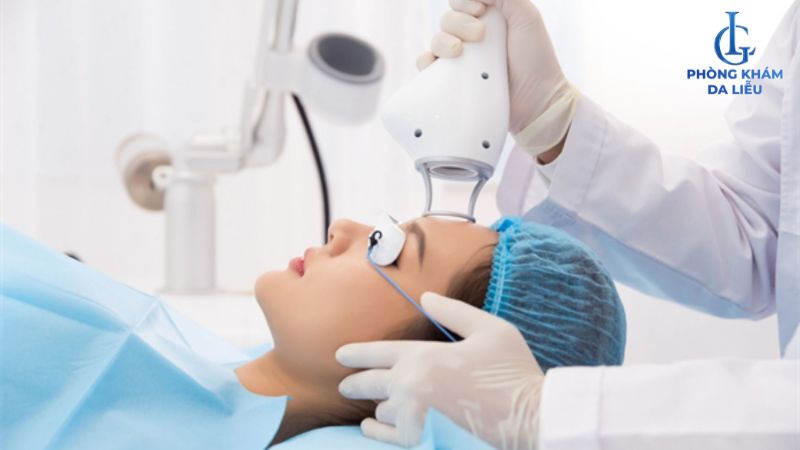 Trị sẹo rỗ bằng Laser CO2 có hết không?