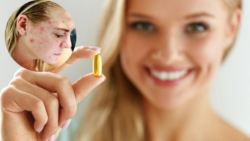 Vitamin E hỗ trợ trị mụn