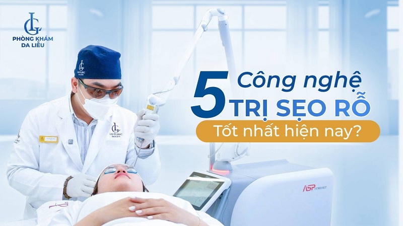 5 công nghệ điều trị sẹo rỗ tốt nhất hiện nay