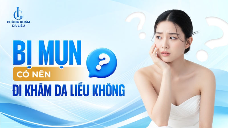 Bị mụn có nên đi khám da liễu không?
