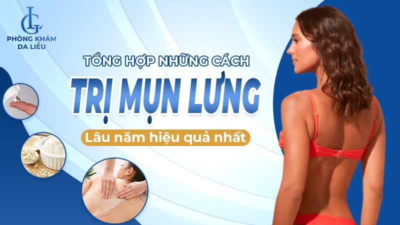 cách trị mụn lưng tại nhà
