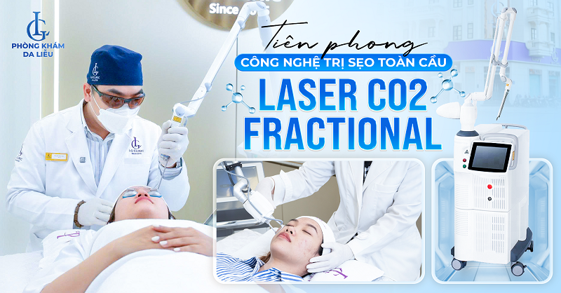trị sẹo rỗ lâu năm bằng Laser CO2 Fractional