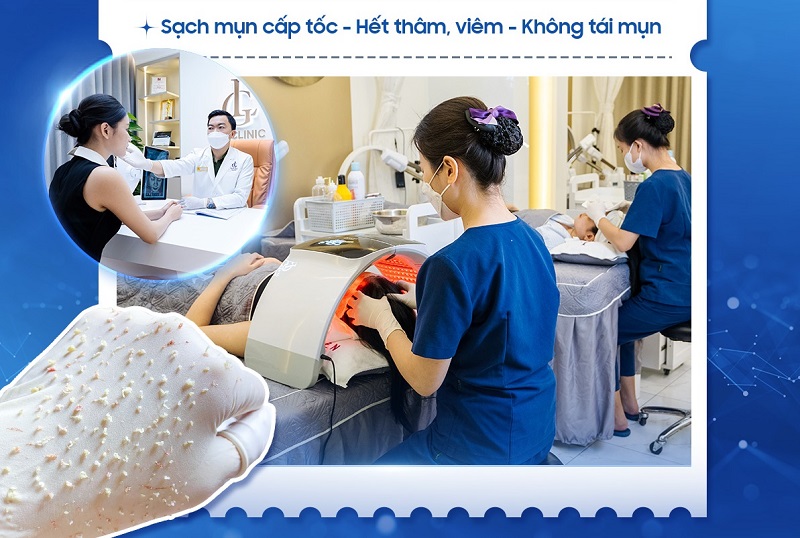 spa trị mụn