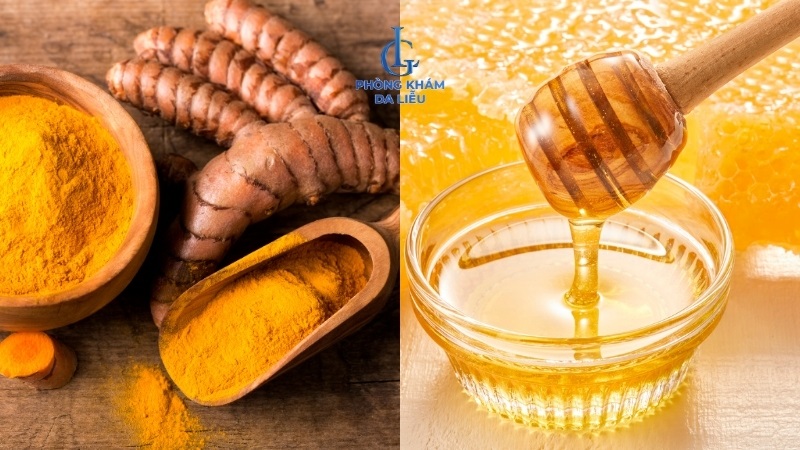 nghệ và mật ong