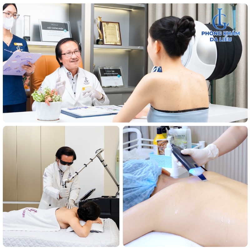 Bác sĩ thăm khám và trị mụn lưng