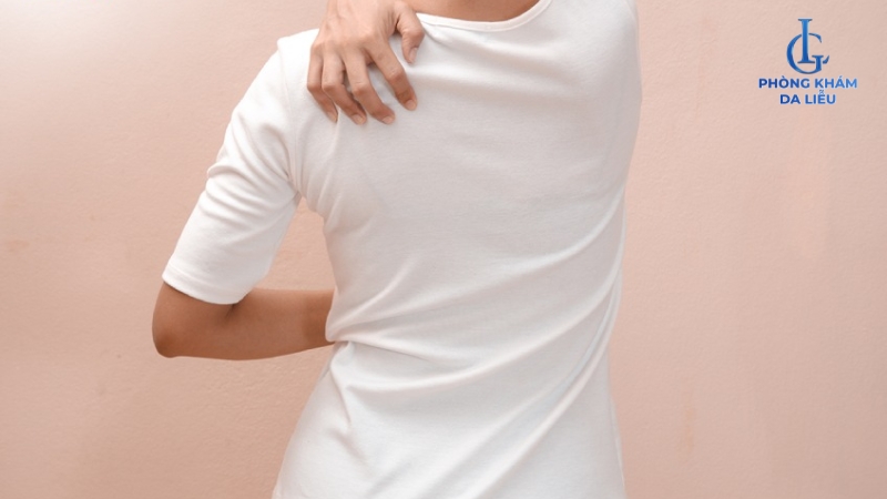 Nguyên nhân gây mụn lưng ở nữ giới