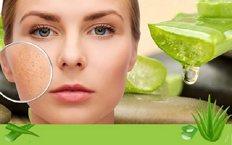 Nha đam chữa sẹo rỗ