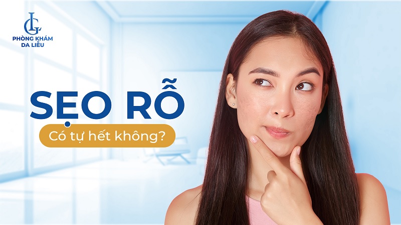 sẹo rỗ có tự hết không