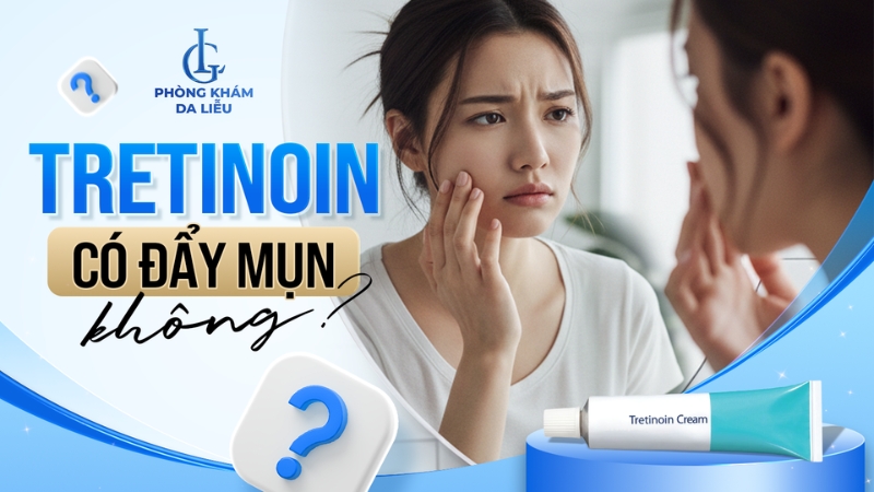 Tretinoin có đẩy mụn không