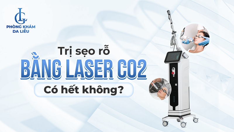 Trị sẹo rỗ bằng laser CO2 có hết không?