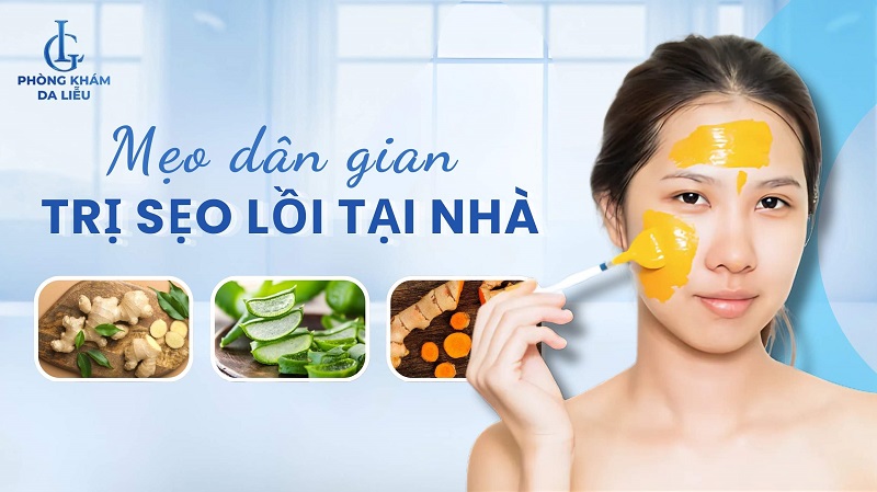 cách trị sẹo lồi tại nhà