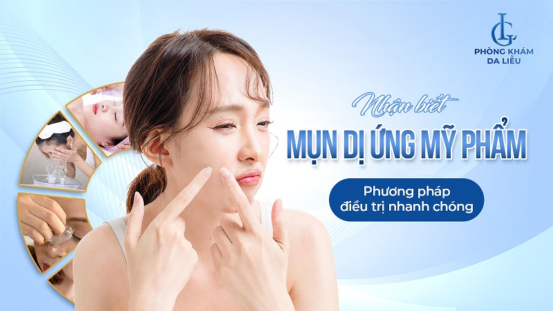 Mụn dị ứng mỹ phẩm